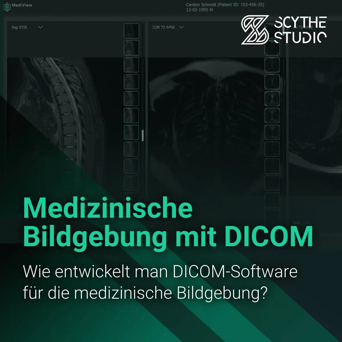 Medizinische Bildgebung mit DICOM